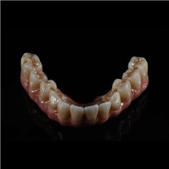 Mewnblaniad Pont Zirconia