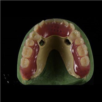 Peek Fframwaith dannedd gosod