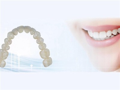 Allanoli Labordai Deintyddol: Manteision, Anfanteision ac Ystyriaethau Allweddol