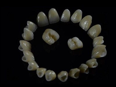 Coronau Zirconia Lab Deintyddol: Ansawdd, Proses, a Beth i Edrych amdano mewn...