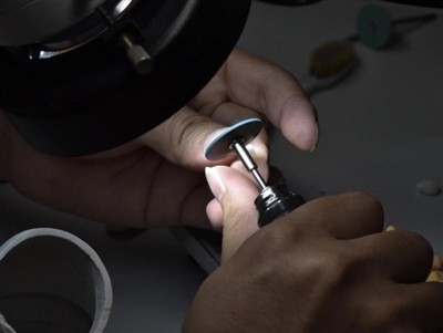 Pa mor Hir Mae Coronau PFM yn Para? Hyd Oes Cyfartalog, Ffactorau a Chynghori...