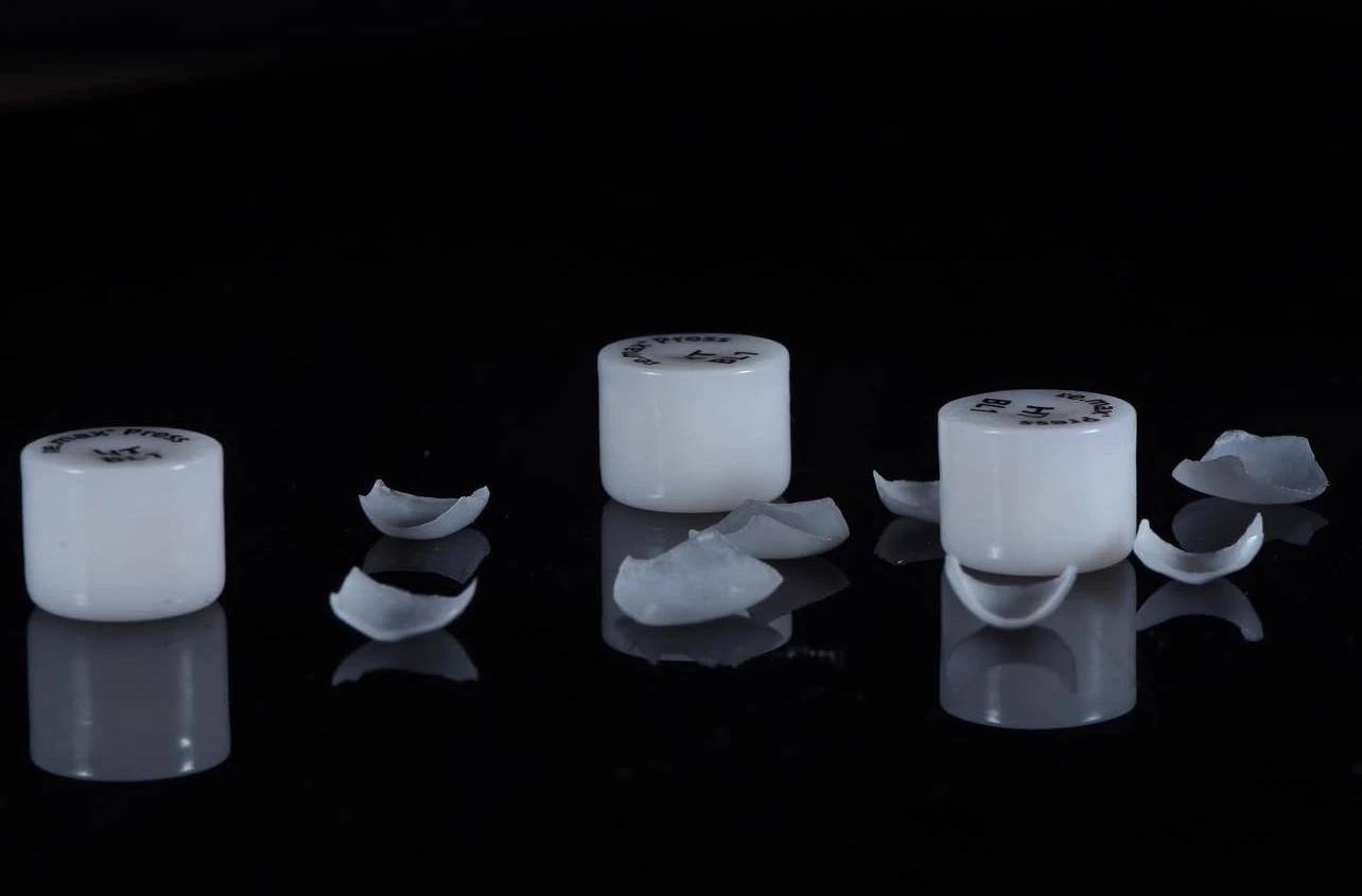 What Are Full-Contour E.max Veneers? What Are Full-Contour E.max Veneers?
