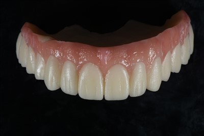 Coron Dros Dro Acrylig Resin