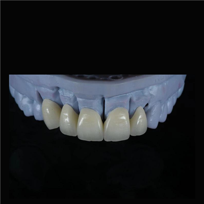 Coron Zirconia Esthetig a Chryf