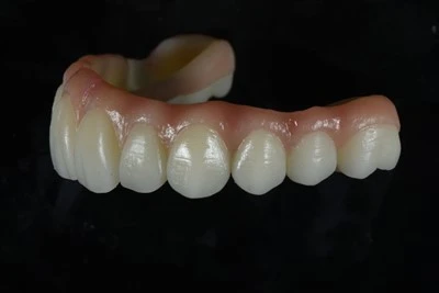 Mewnblaniad{0}}Cefnogaeth Llawn-Arch Zirconia Bridge