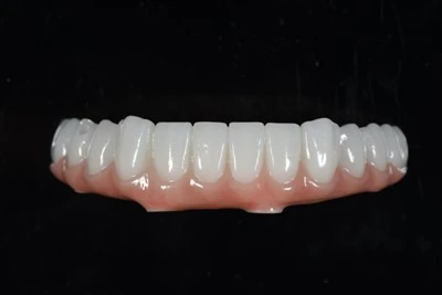 Mandibwlaidd Pawb-ar-X Zirconia Bridge